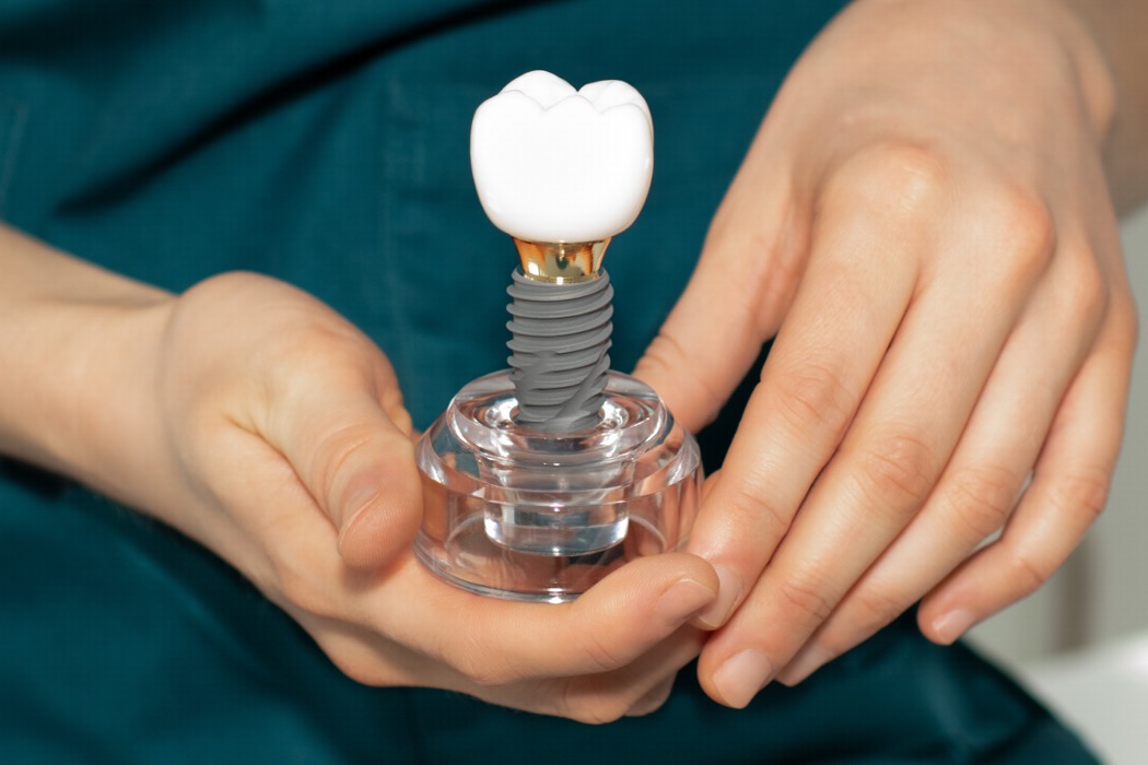 implant diş fiyatları 2026