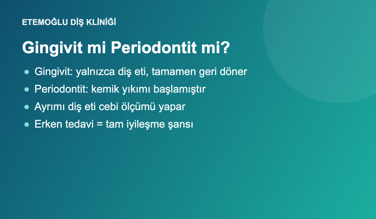 Diş eti iltihabı evreleri: gingivit ve periodontit farkı